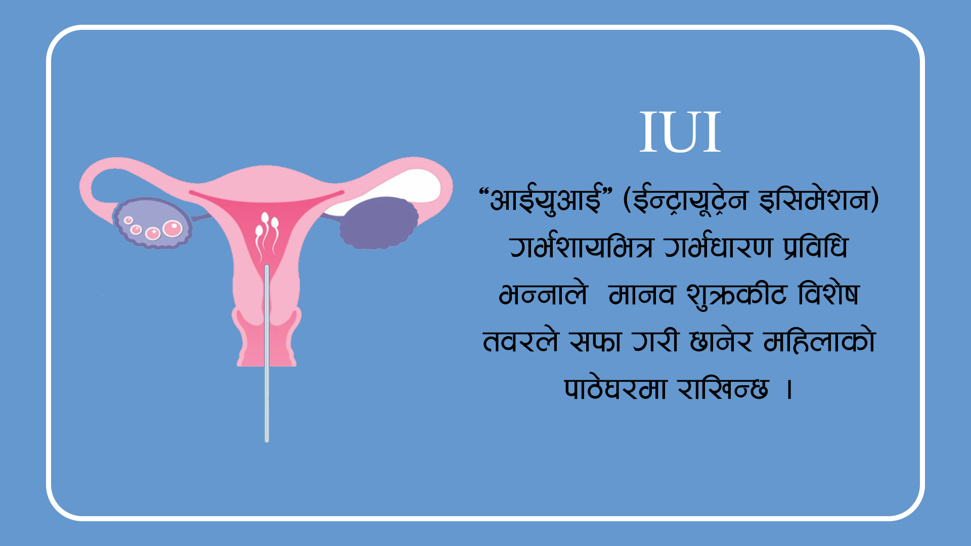 IUI