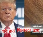 धेरै हात मिलाउदा डोनल्ड ट्रमको हातमा इन्फेक्सन
