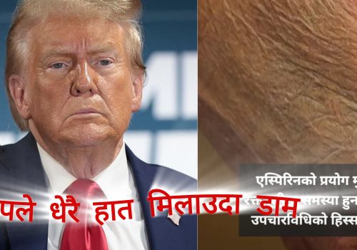 धेरै हात मिलाउदा डोनल्ड ट्रमको हातमा इन्फेक्सन