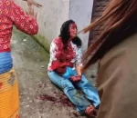 गोकर्णेश्वरमा महिलामाथि खुकुरी प्रहार, एक जना पक्राउ