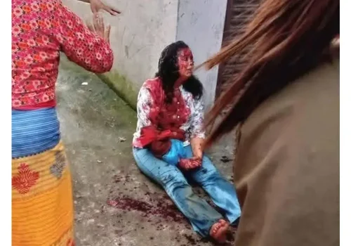 गोकर्णेश्वरमा महिलामाथि खुकुरी प्रहार, एक जना पक्राउ