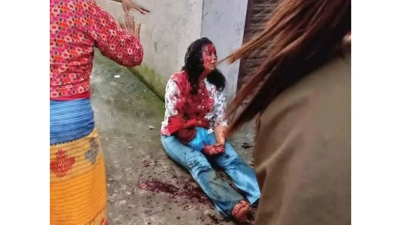 गोकर्णेश्वरमा महिलामाथि खुकुरी प्रहार, एक जना पक्राउ